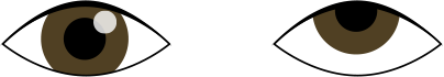 上斜視