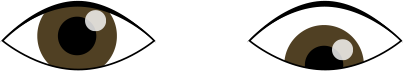 下斜視