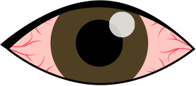 充血